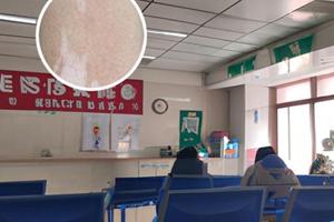 308光療儀新舊對(duì)比