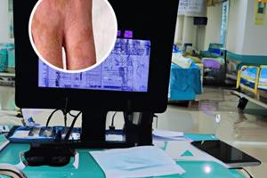 308照光在家怎樣照