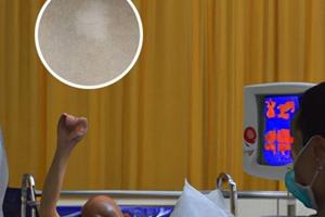 他克莫司軟膏可以與三氯生乳膏一起用嗎