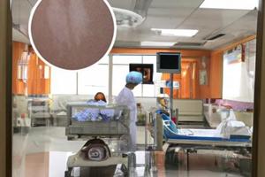 手指白癜風(fēng)308用多大劑量