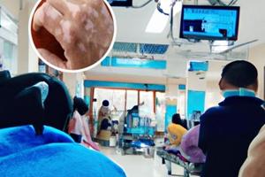 308光療后多久可以沾水