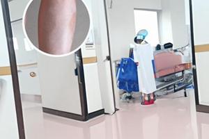 小孩臉上有白斑是缺鋅嗎怎么補呢