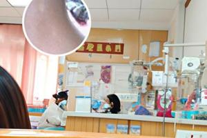 兒童白癜風對孩子的影響