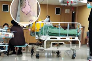 開封中醫看白癜風怎么樣